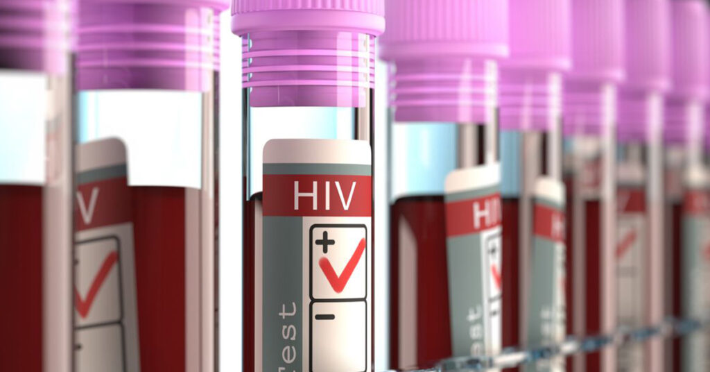 στέλεχος του HIV ανθεκτικό